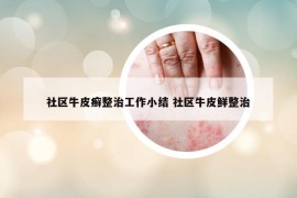 社区牛皮癣整治工作小结 社区牛皮鲜整治