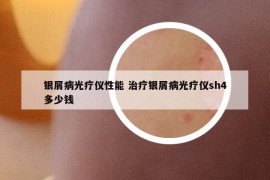 银屑病光疗仪性能 治疗银屑病光疗仪sh4多少钱
