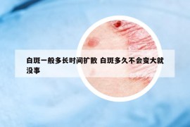 白斑一般多长时间扩散 白斑多久不会变大就没事