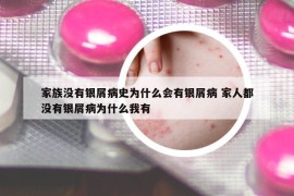 家族没有银屑病史为什么会有银屑病 家人都没有银屑病为什么我有
