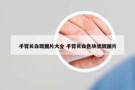 手臂长白斑图片大全 手臂长白色块状斑图片