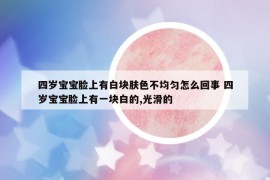 四岁宝宝脸上有白块肤色不均匀怎么回事 四岁宝宝脸上有一块白的,光滑的