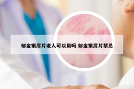 郁金银屑片老人可以用吗 郁金银屑片禁忌