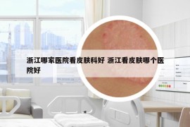 浙江哪家医院看皮肤科好 浙江看皮肤哪个医院好