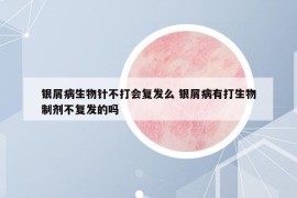 银屑病生物针不打会复发么 银屑病有打生物制剂不复发的吗