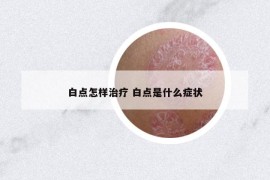 白点怎样治疗 白点是什么症状