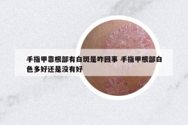 手指甲靠根部有白斑是咋回事 手指甲根部白色多好还是没有好