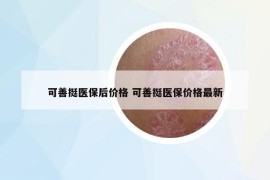 可善挺医保后价格 可善挺医保价格最新