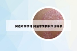 阿达木生物针 阿达木生物制剂说明书