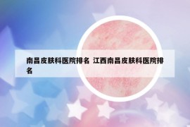 南昌皮肤科医院排名 江西南昌皮肤科医院排名