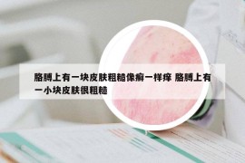 胳膊上有一块皮肤粗糙像癣一样痒 胳膊上有一小块皮肤很粗糙