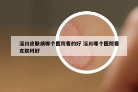 淄川皮肤病哪个医院看的好 淄川哪个医院看皮肤科好