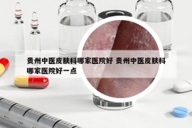 贵州中医皮肤科哪家医院好 贵州中医皮肤科哪家医院好一点