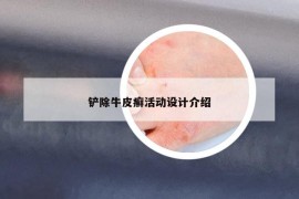 铲除牛皮癣活动设计介绍