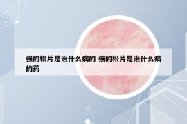 强的松片是治什么病的 强的松片是治什么病的药