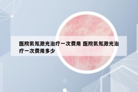 医院氦氖激光治疗一次费用 医院氦氖激光治疗一次费用多少