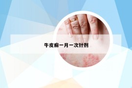 牛皮癣一月一次针剂
