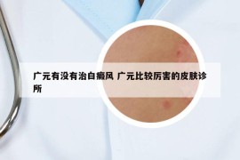 广元有没有治白癜风 广元比较厉害的皮肤诊所