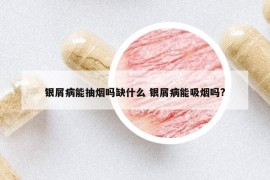 银屑病能抽烟吗缺什么 银屑病能吸烟吗?