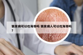银屑病可以吃诲带吗 银屑病人可以吃海带吗?