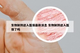 生物制剂进入医保最新消息 生物制剂进入医保了吗