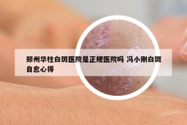 郑州华柱白斑医院是正规医院吗 冯小刚白斑自愈心得