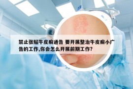禁止张贴牛皮癣通告 要开展整治牛皮癣小广告的工作,你会怎么开展前期工作?