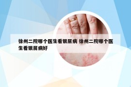 徐州二院哪个医生看银屑病 徐州二院哪个医生看银屑病好