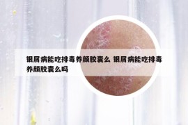 银屑病能吃排毒养颜胶囊么 银屑病能吃排毒养颜胶囊么吗