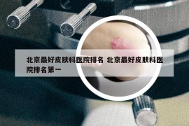 北京最好皮肤科医院排名 北京最好皮肤科医院排名第一