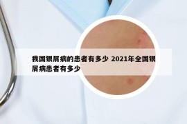 我国银屑病的患者有多少 2021年全国银屑病患者有多少