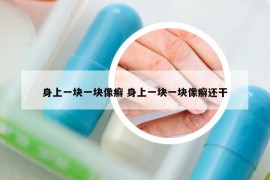 身上一块一块像癣 身上一块一块像癣还干