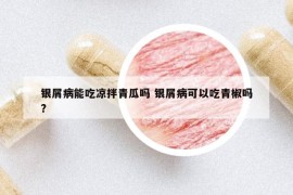 银屑病能吃凉拌青瓜吗 银屑病可以吃青椒吗?