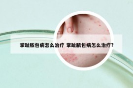 掌趾脓包病怎么治疗 掌趾脓包病怎么治疗?