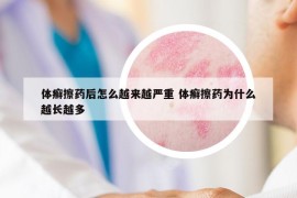 体癣擦药后怎么越来越严重 体癣擦药为什么越长越多