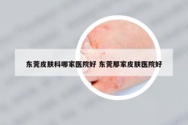 东莞皮肤科哪家医院好 东莞那家皮肤医院好