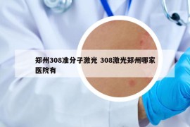 郑州308准分子激光 308激光郑州哪家医院有