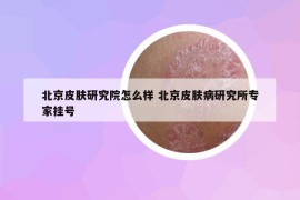 北京皮肤研究院怎么样 北京皮肤病研究所专家挂号