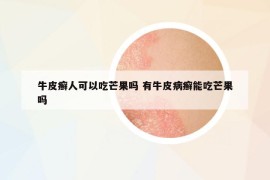 牛皮癣人可以吃芒果吗 有牛皮病癣能吃芒果吗