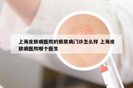 上海皮肤病医院的银屑病门诊怎么样 上海皮肤病医院哪个医生
