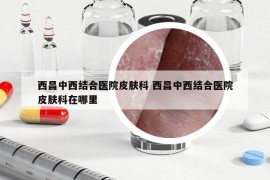 西昌中西结合医院皮肤科 西昌中西结合医院皮肤科在哪里