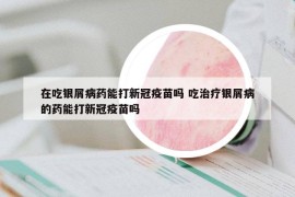 在吃银屑病药能打新冠疫苗吗 吃治疗银屑病的药能打新冠疫苗吗