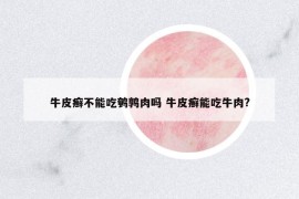 牛皮癣不能吃鹌鹑肉吗 牛皮癣能吃牛肉?