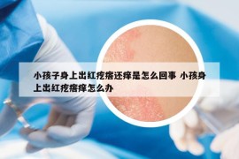 小孩子身上出红疙瘩还痒是怎么回事 小孩身上出红疙瘩痒怎么办