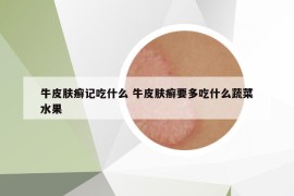 牛皮肤癣记吃什么 牛皮肤癣要多吃什么蔬菜水果