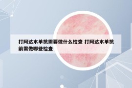 打阿达木单抗需要做什么检查 打阿达木单抗前需做哪些检查