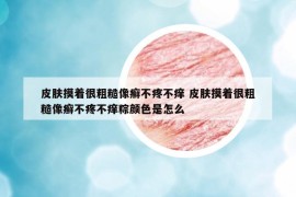 皮肤摸着很粗糙像癣不疼不痒 皮肤摸着很粗糙像癣不疼不痒粽颜色是怎么
