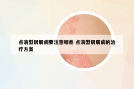 点滴型银屑病要注意哪些 点滴型银屑病的治疗方案
