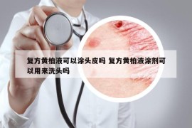 复方黄柏液可以涂头皮吗 复方黄柏液涂剂可以用来洗头吗