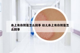 身上有白斑是怎么回事 幼儿身上有白斑是怎么回事